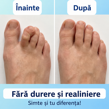 Alinia™ – Corector pentru Degete – Set pentru ambele picioare